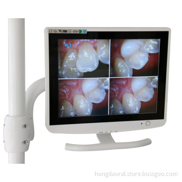 15 Inch White Dental LCD Monitor for Dental Camera with VGA & Video & HDMI & USB Jack